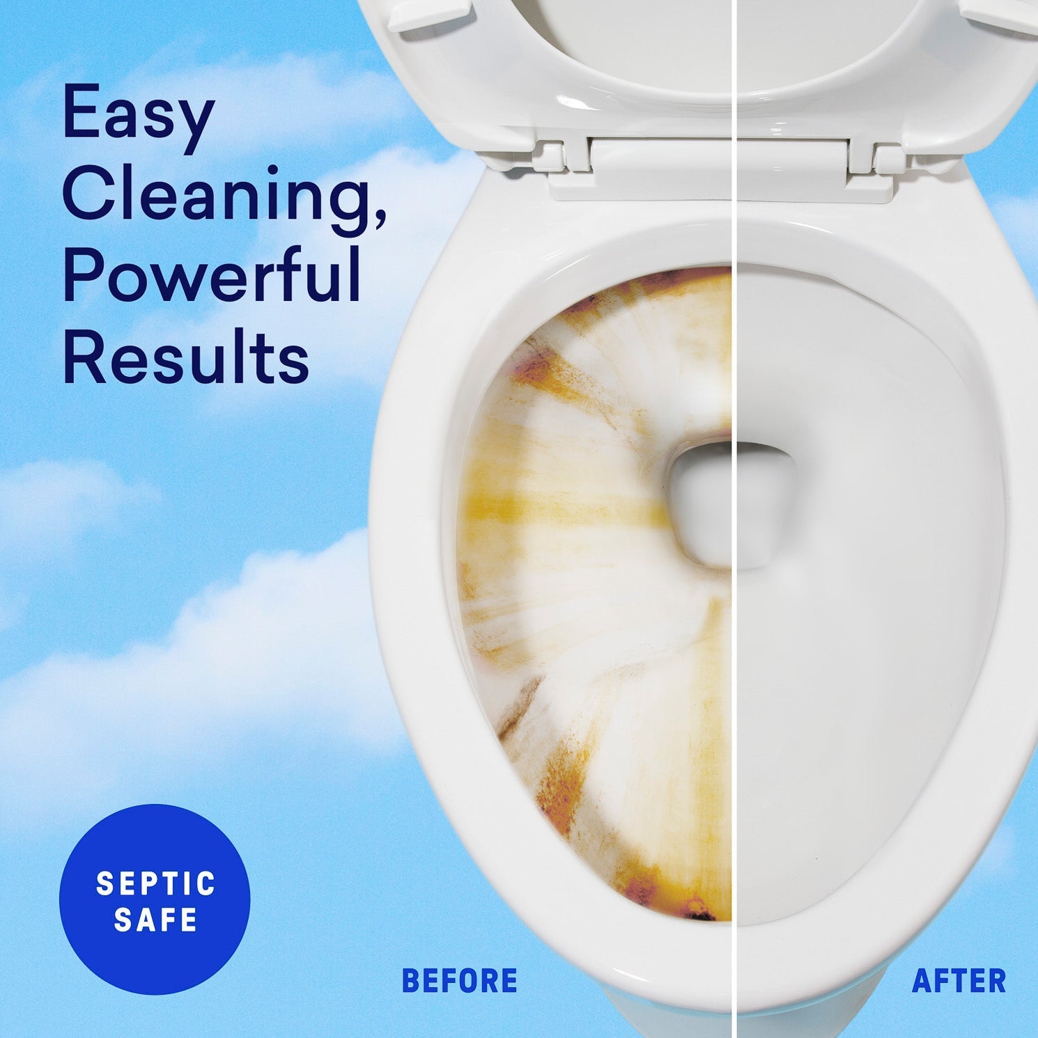 Toilet Bowl Cleaner Starter Set